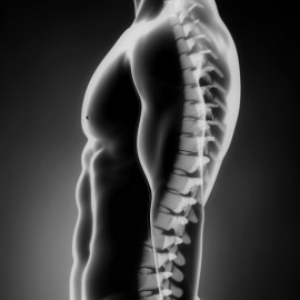 Bone (Arthritis) Problems